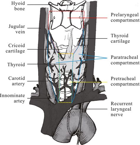 Laryngeal Lymph Nodes