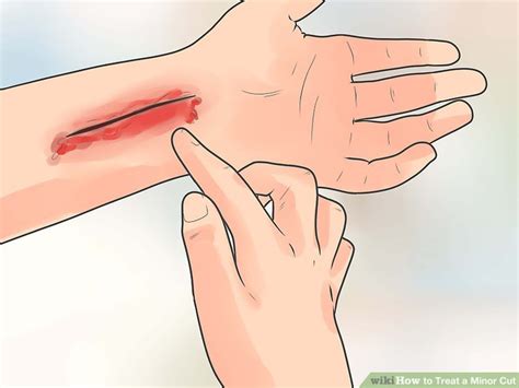 How To Treat A Minor Cut 13 Steps With Pictures Wikihow