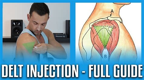 How To Do A Deltoid Injection Full Guidedemo Youtube