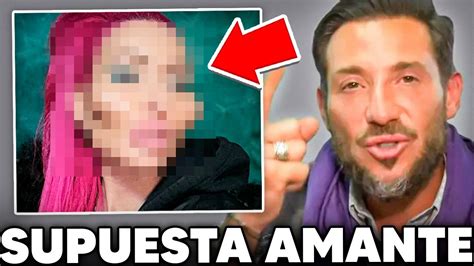 Supuesta Amante De Antonio David Le Deja Morado El Brazo Porque No Se Lo Suelta Youtube