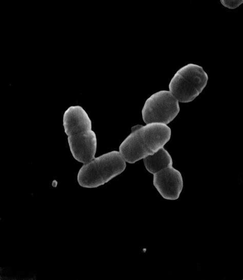 Lactobacillus Sp Sem Photograph By Stem Jems