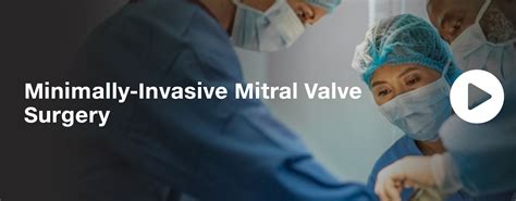 Minimally Invasive Mitral Valve Surgery Ucsf Department Of Surgery