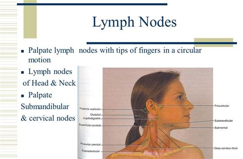 Headache Lymph Nodes Swollen Cluster Headaches