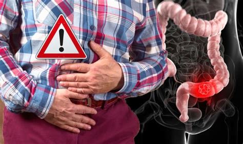 Cancer Symptoms Signs Of A Bowel Tumour Include Stomach Bloating Pain Express Co Uk
