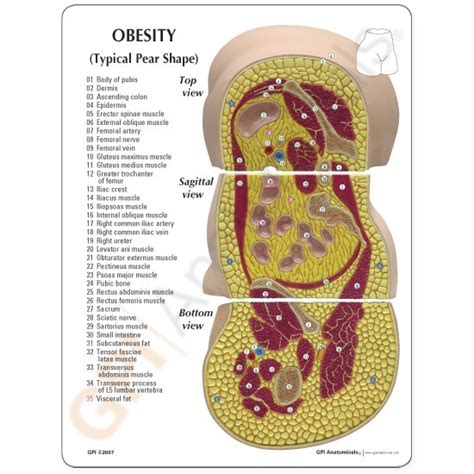 Anatomical Model Obesity Model