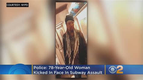 Police 78 Year Old Woman Kicked In Face In Vicious Subway Assault