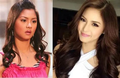 Filipino Celebrities Before And After