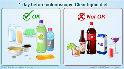 Whether you are trying to perfect your recipe or make one for the first time, you will want to check out this step by step. What is a colonoscopy and how do I prepare for it? | Clear liquid diet, Colonoscopy, Clear ...