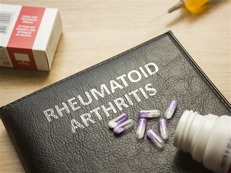 Artrite Reumatoide Alimentos E Tratamentos Que Aliviam As Dores
