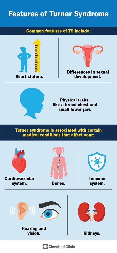 Turner Syndrome What It Is Causes Symptoms And Treatment