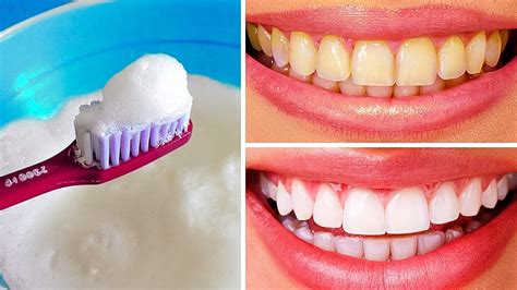 Others won't and might harm your teeth or gums. 10 Natural Ways to Whiten Teeth at Home - YouTube
