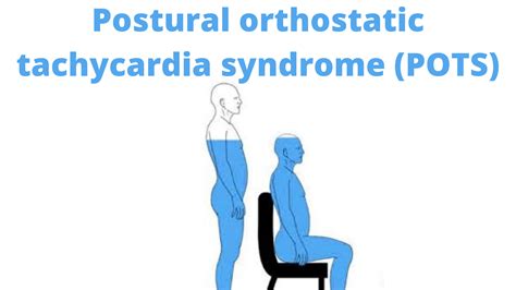 Nutrition Diet And Postural Orthostatic Tachycardia Syndrome Pots