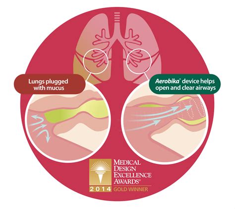 Constantly Coughing From Mucus Or Copd Help Open And Clear Your Lungs