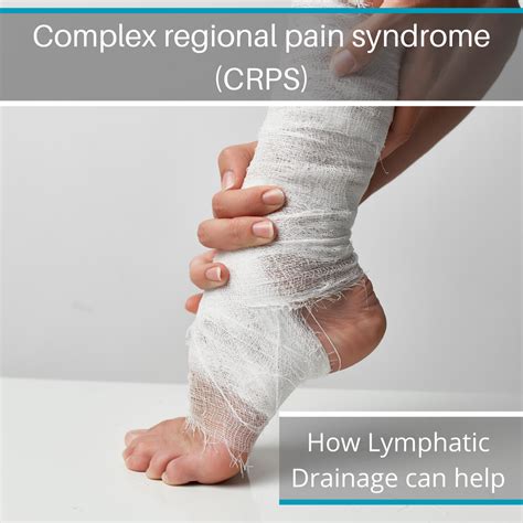 Complex Regional Pain Syndrome Crps Perea Clinic