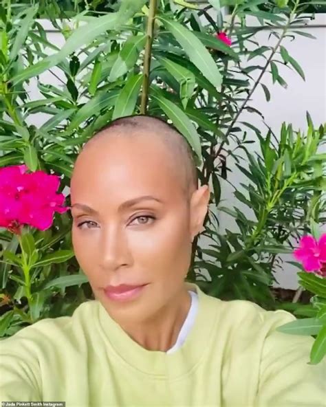 jada pinkett smith s history of alopecia the autoimmune disease that caused her hair loss s