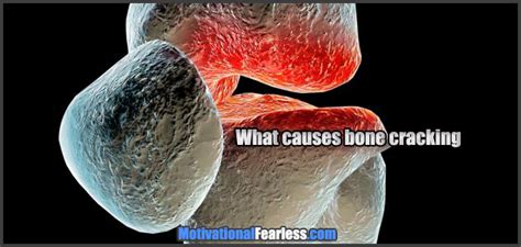 what causes bone cracking motivational fearless