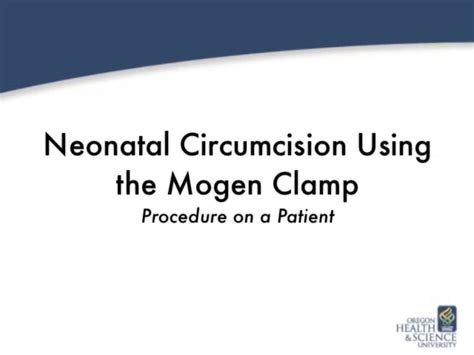 Neonatal Circumcision Using The Mogen Clamp On A Patient On Vimeo
