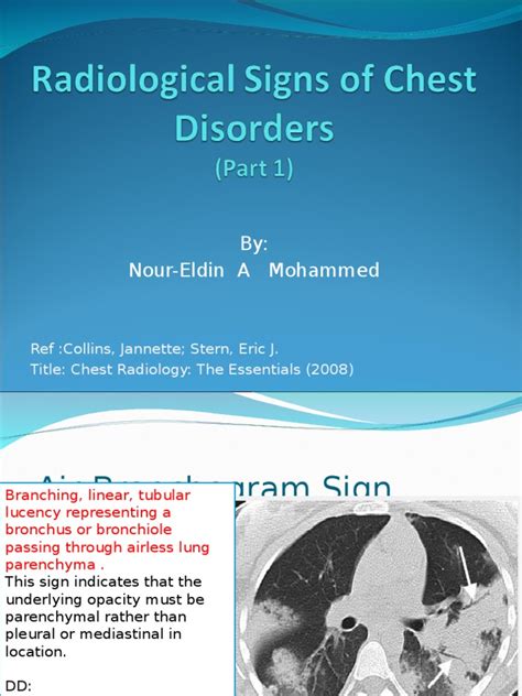 Radiological Chest Signs Pdf Lung Thorax