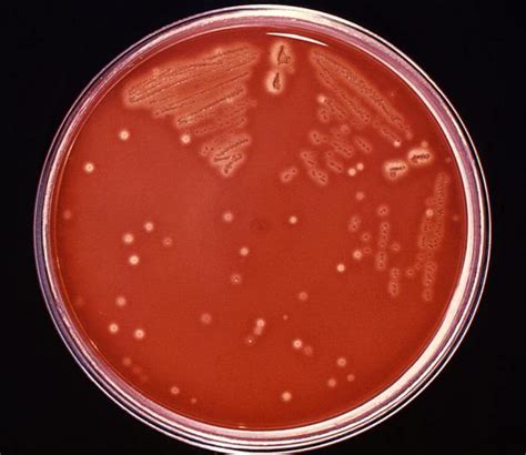 Streptococcus Pyogenes Group A Streptococcus Gas An Overview