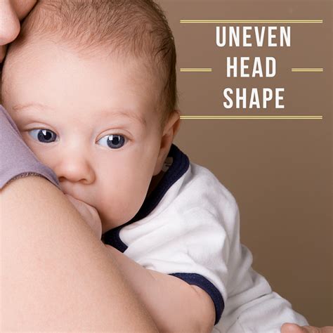 Uneven Infants Head Shape Day Care Quincy Ma A Childs View Centers