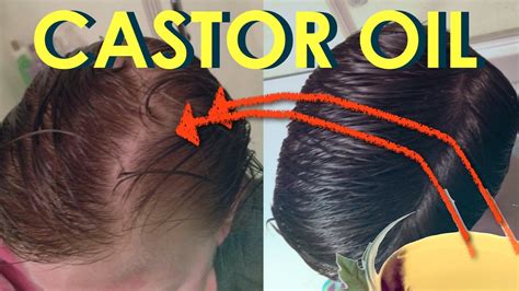 Castor Oil For Hair Growth Before And After Photos Stop Hair Loss With Castor Oil Grow Sexy