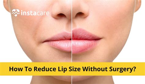 How To Reduce Lip Size Without Surgery