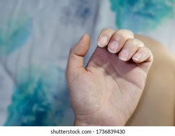Long Dirty Fingernails Source Viruses Dirt Stock Photo Shutterstock