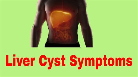 Symptoms Of A Cyst On The Liver Youtube