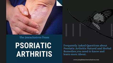 Psoriatic Arthritis Natural Remedies Jmexclusives Research Guide