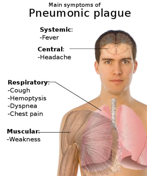 Pneumonic Plague Symptoms Health And Medical Pictures Diagrams