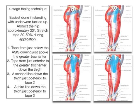 Image Result For Tendinosis Of Hips Hip Flexor Kinesiology Taping