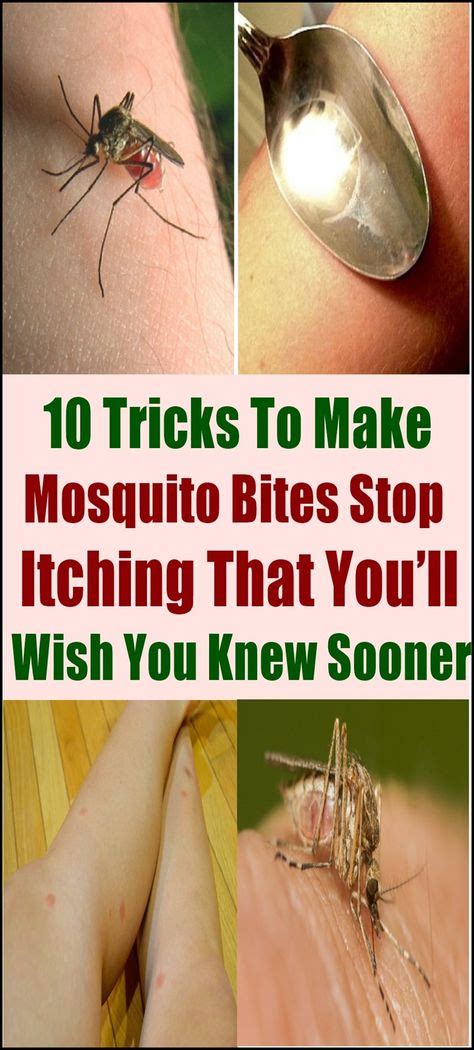 10 Tricks To Make Mosquito Bites Stop Itching That Youll Wish You Knew Sooner Remedies For