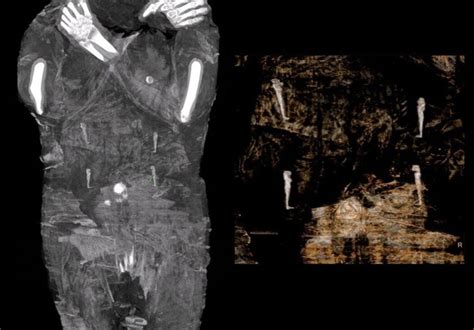 world s first known case of a pregnant mummy discovered by researchers archaeology world