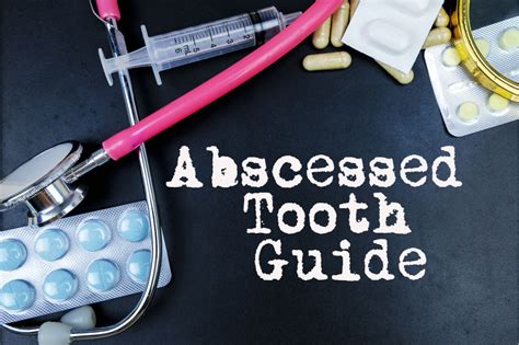 How To Drain A Tooth Abscess At Home With A Needle Very Hot Log Book