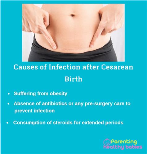 Post Cesarean Wound Infection Parentinghealthybabies Com