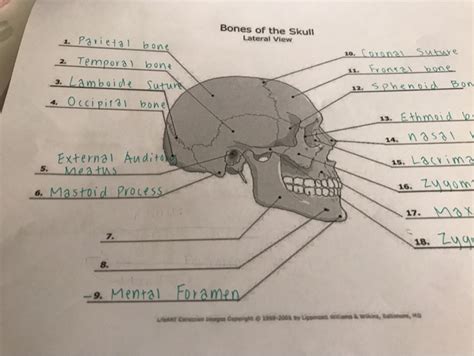 Bones Of The Skull Lateral View Anatomy Of The Adult Human Skull