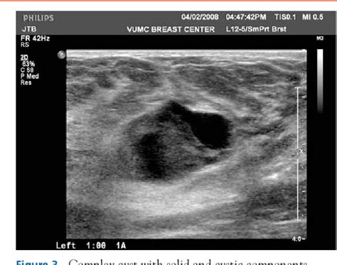 Figure 3 From The Sonographic Findings And Differing Clinical