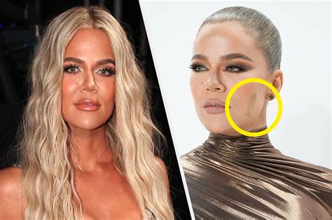 Khloé Kardashian Explained Why She s Still Wearing A Band Aid Months After Having Her Facial