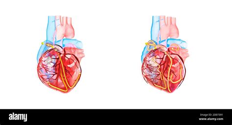 Human Heart And Its Electrical System 3d Illustration The Yellow