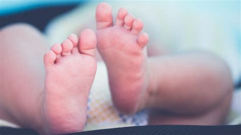 Doctors Notice Recent Uptick In So Called Covid Toes Cases In Children