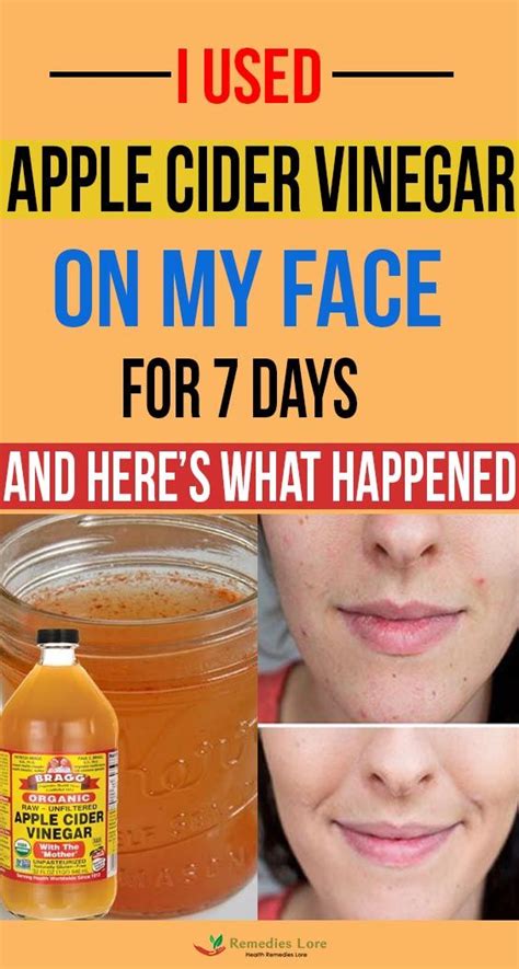 I Used Apple Cider Vinegar On My Face For 7 Days And Heres What Happened Apple Cider Vinegar
