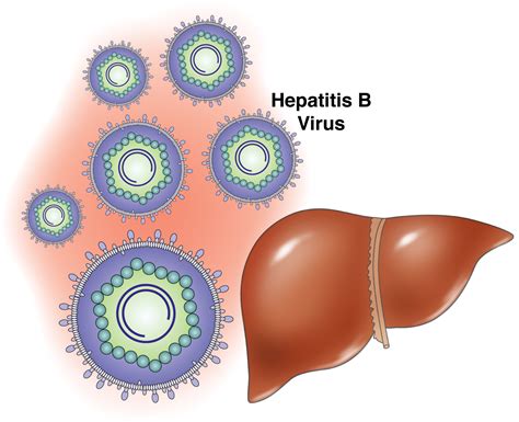 Hepatitis B Causes Symptoms Treatment Hepatitis B