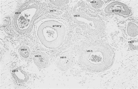 Hls Male Reproductive System Spermatic Cord Pampiniform Plexus Med
