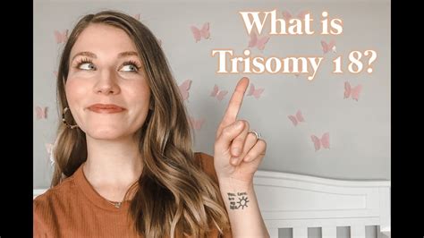 What Is Trisomy 18 Edwards Syndrome Trisomy 18 101 Youtube