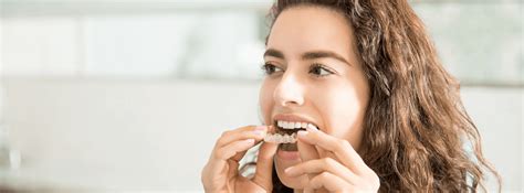 Does Invisalign® Widen Your Jaw National Dental Care Db Dental