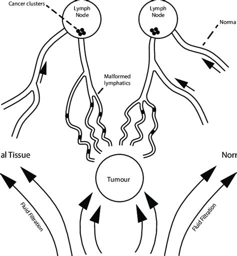 Schematic Of Lymphatic Flow Within Tumours And Normal Surrounding