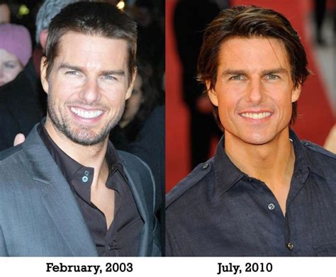 Tom Cruise Is Becoming Younger With Help Of Plastic Surgery