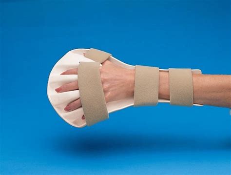 Occupational Therapy Splinting Variety Of Splint