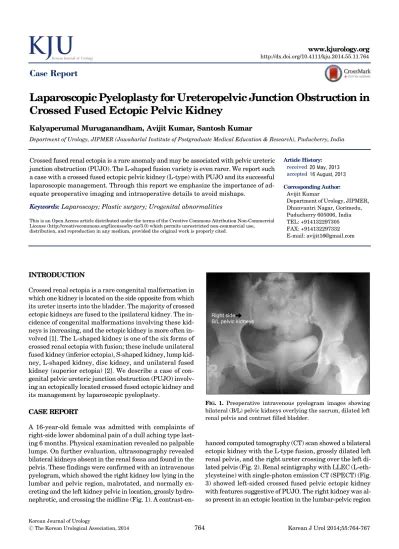 Laparoscopic Pyeloplasty For Ureteropelvic Junction Obstruction In