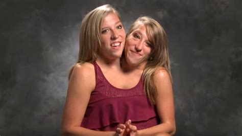 Conjoined Twin Sisters Abby And Brittany Hensel Where Are They Now